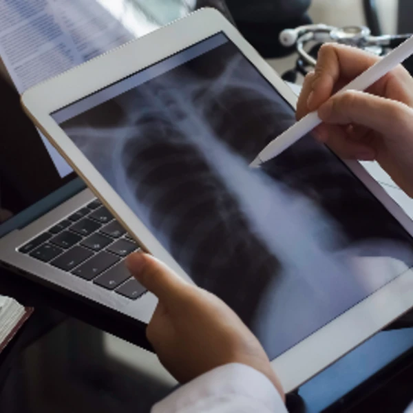 Healthcare Company Assures Private 5G LTE Environment with NETSCOUT Solutions